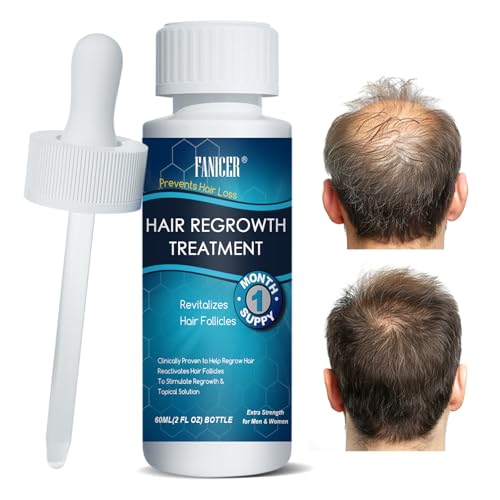 60ml Haarwachstum Serum Zum Haarwachstum Beschleunigen Gesundes Haar